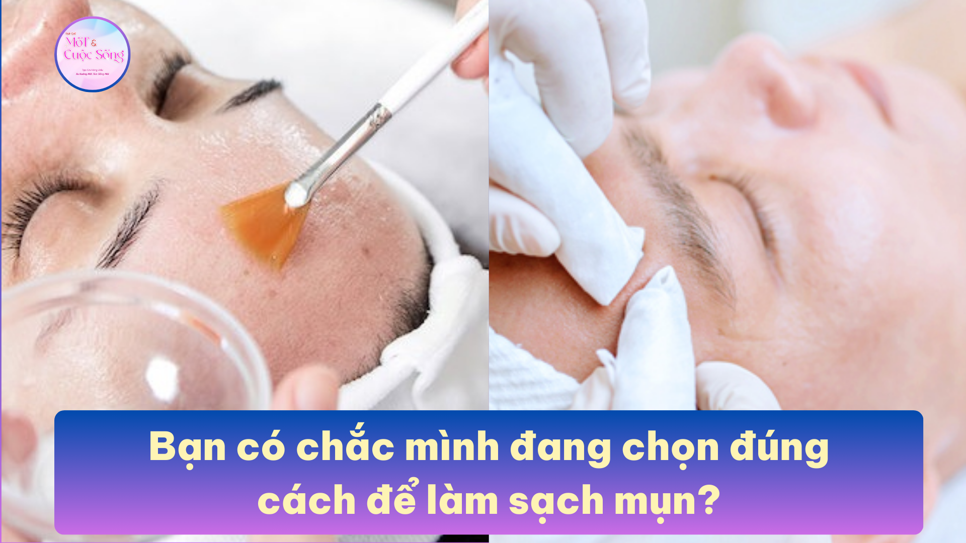  Bạn có chắc mình đang chọn đúng cách để làm sạch mụn?