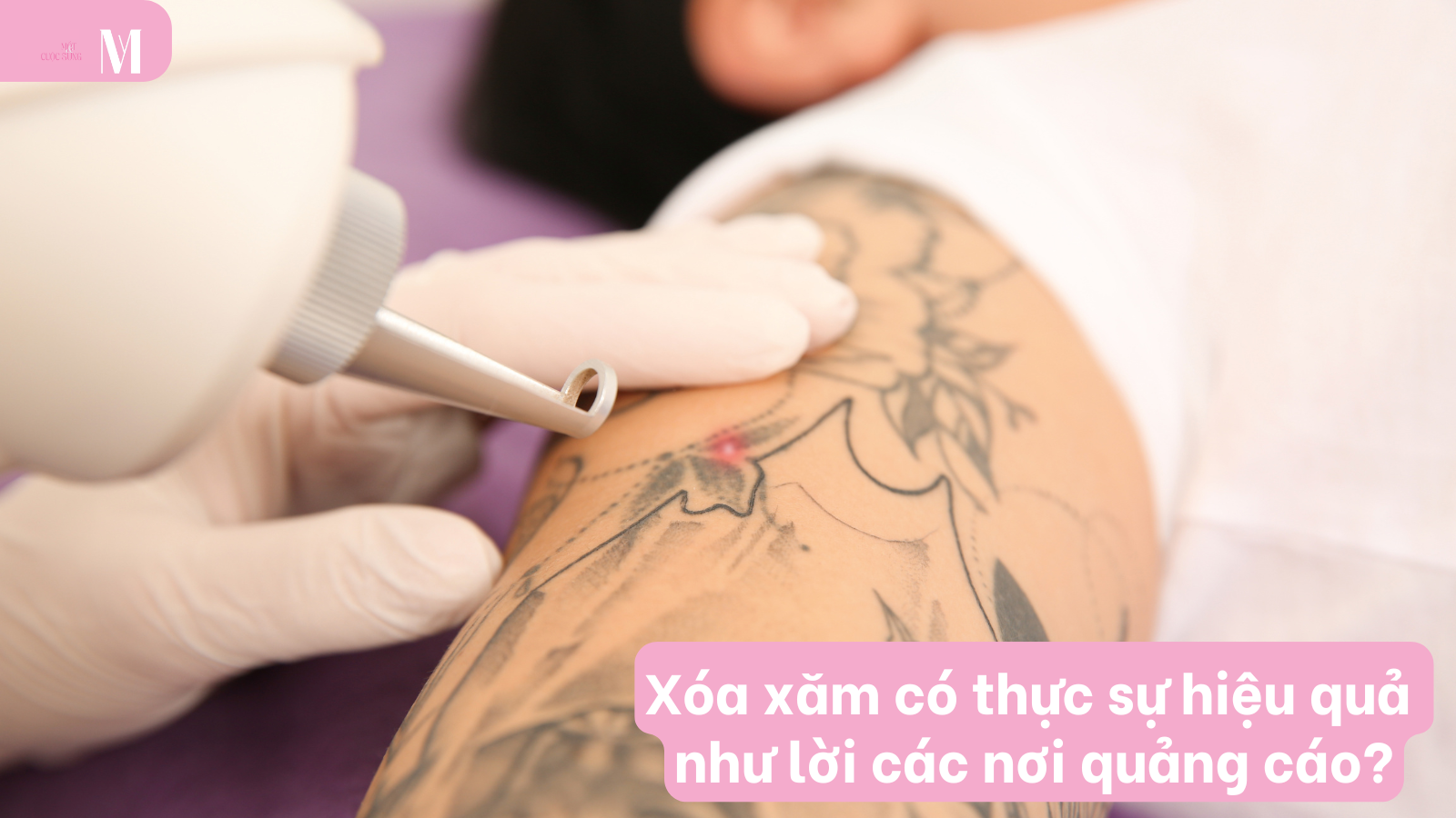  Xóa xăm có thực sự hiệu quả như lời các nơi quảng cáo?