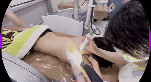 trải qua hơn 30 buổi xoá xăm bằng công nghệ laser