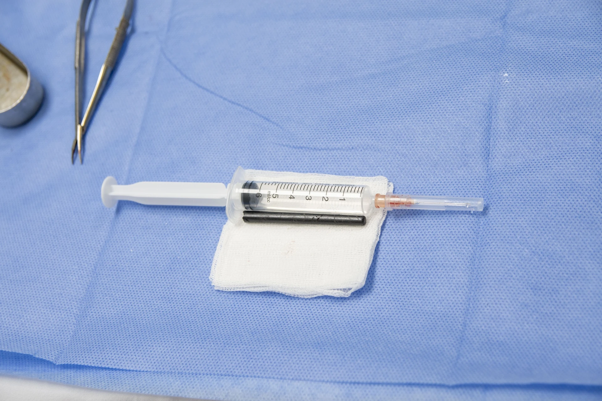 . Dị vật được đẩy từ từ từ xoang hàm đến hốc mũi rồi rút ra ngoài qua lối mũi.