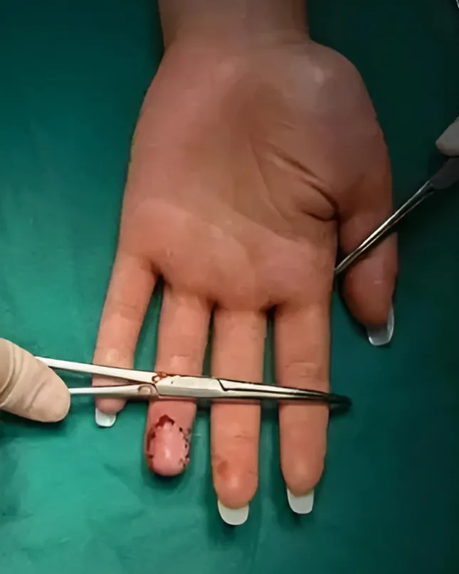 Lớp "cách cảm giác" của móng tay làm đẹp