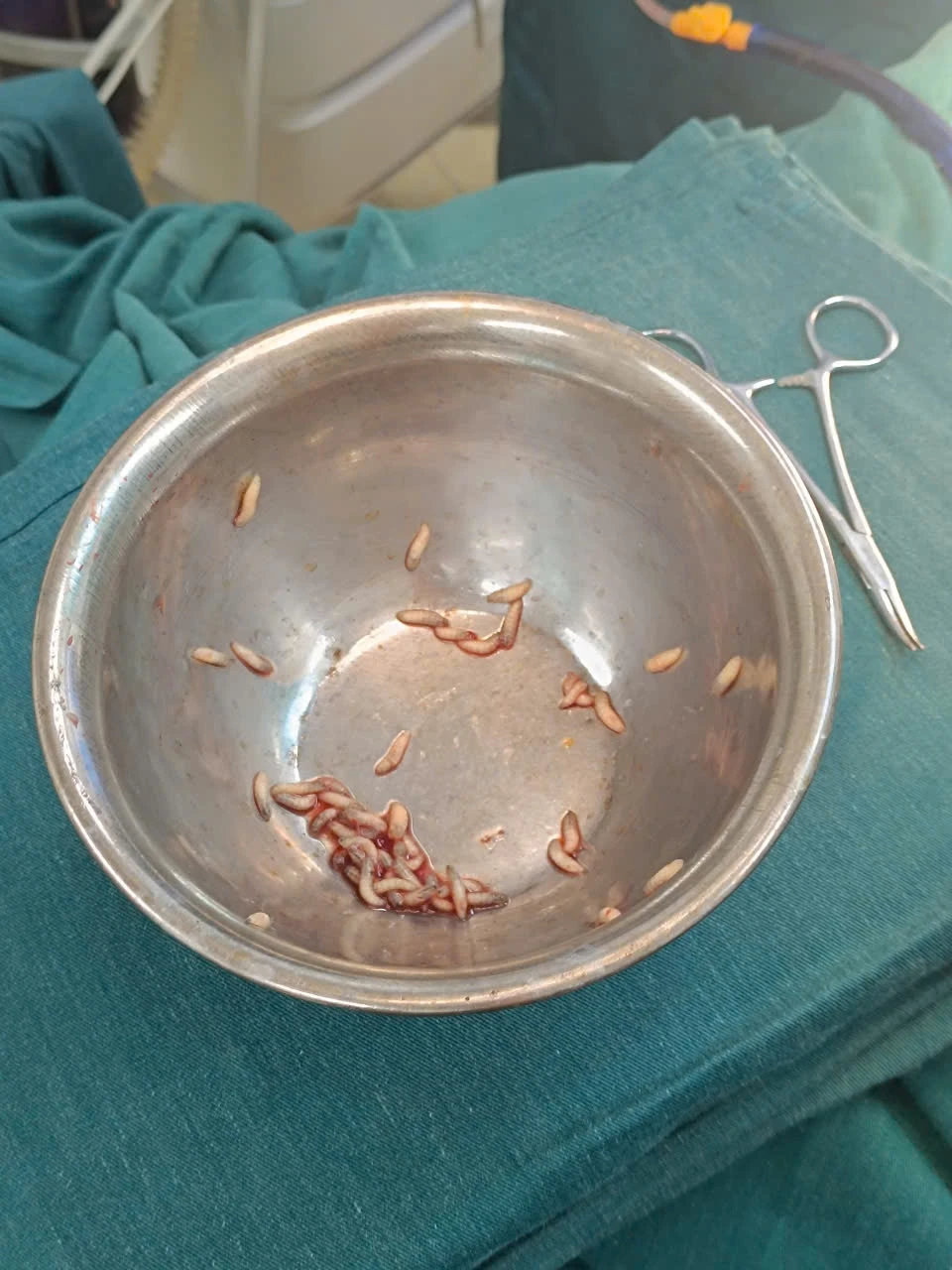 Câu chuyện cảnh báo về thói quen tự điều trị tại nhà.