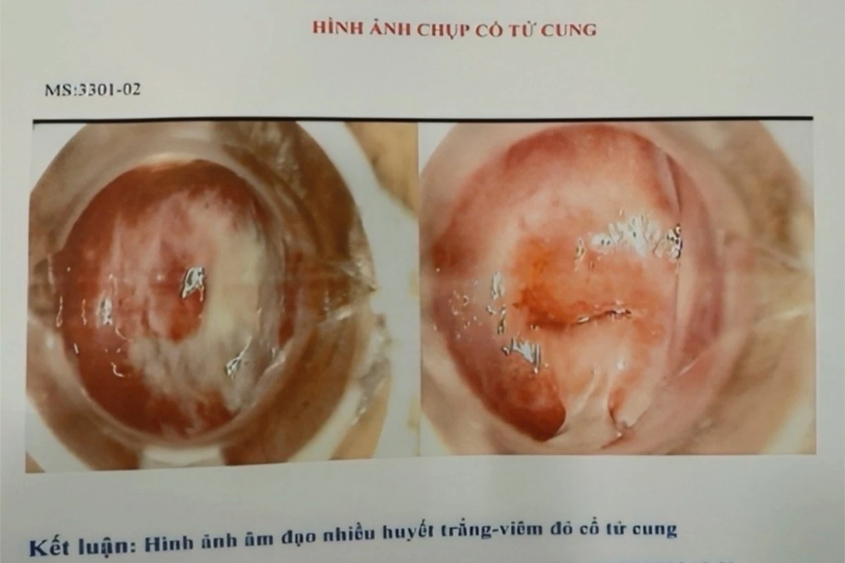 Phát hiện hàng trăm ảnh nội soi không rõ danh tính