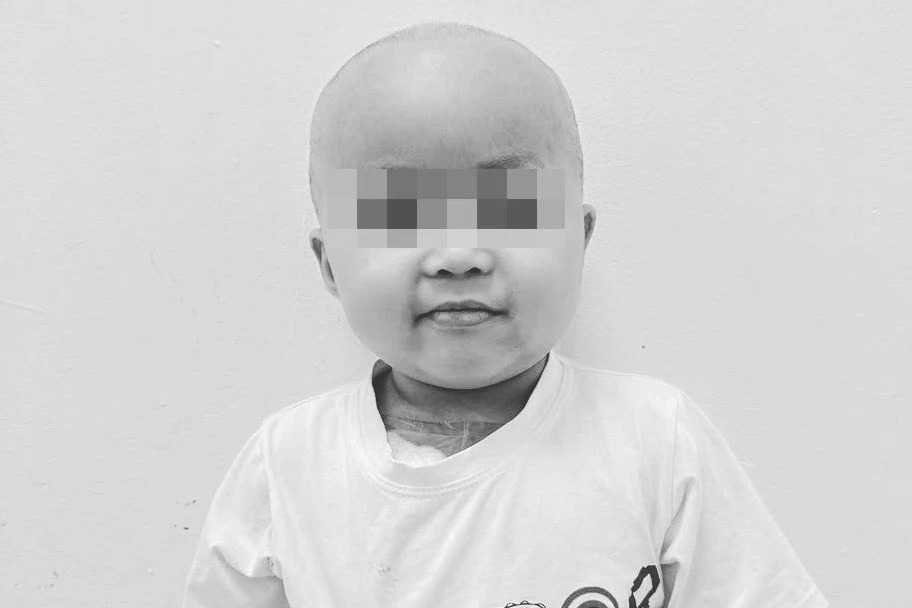 Bé Bắp qua đời sau thời gian điều trị bệnh