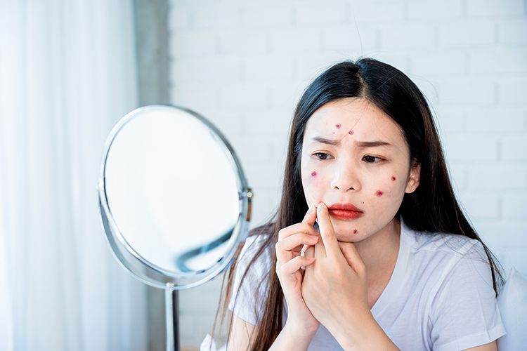 Khi làn da trưởng thành cũng cần được “an ủi”