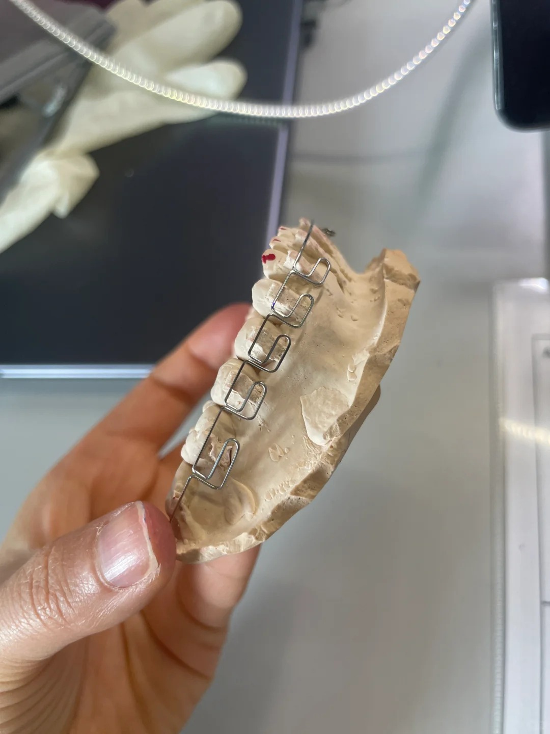 Meaw - Geaw lại nổi lên như một “người chơi mới” biết chiều lòng giới trẻ khi không chỉ sắp xếp răng ngay ngắn mà còn can thiệp khéo léo vào đường nét gương mặt.