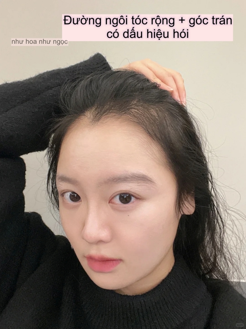 Khi mái tóc trở thành “nỗi đau”