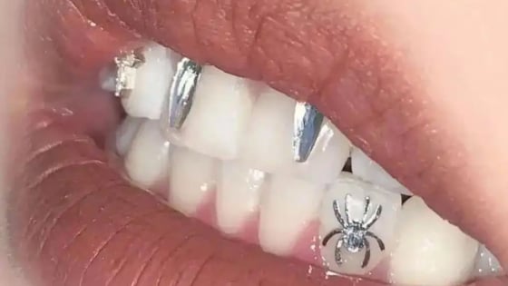 Mỗi “mão răng khắc hình” được rao giá 1.000–2.000 NDT (tương đương 140–280 USD).