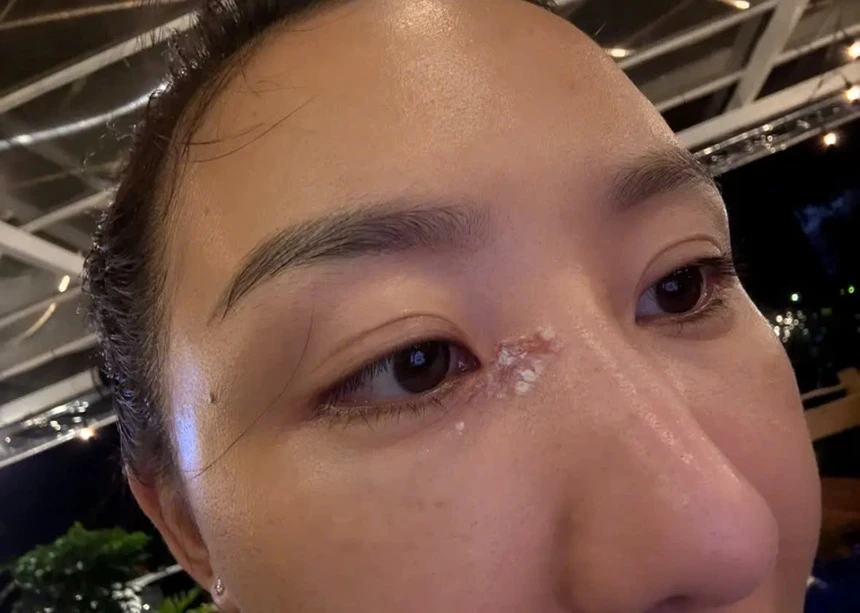 “Không ngờ một chuyện nhỏ lại thành ra như vậy”